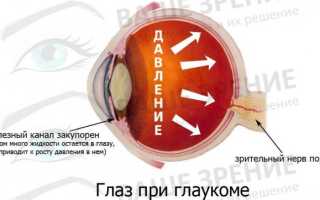 Нет резкости в глазах причины и лечение. Текст расплывается в глазах при чтении. Мутнеет в глазах на фоне головной боли