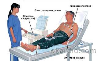 ЭКГ — расшифровка, норма показателей, таблица у взрослых и детей