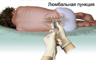 Переносчик возбудителя энцефалита: в какой местности обитает иксодовый клещ