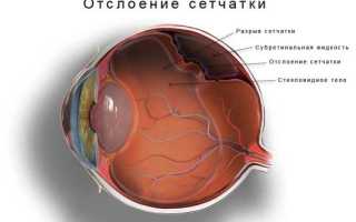 Почему образуется пленка на глазах у человека: лечение и профилактика