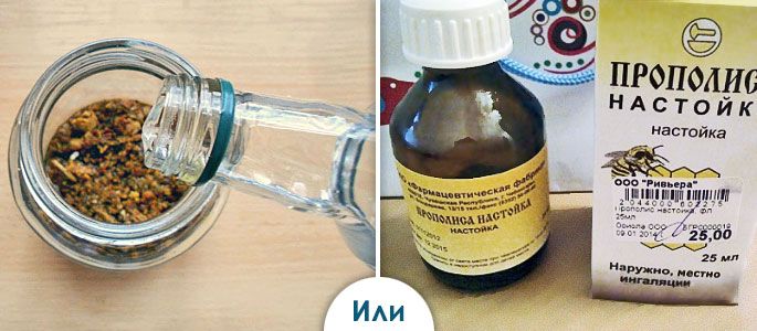 Для лечения фарингита используют спиртовую настойку прополиса, приготовленную в домашних условиях или приобретенную в аптечной сети (на фото) Для лечения фарингита используют спиртовую настойку прополиса, приготовленную в домашних условиях или приобретенную в аптечной сети (на фото)
