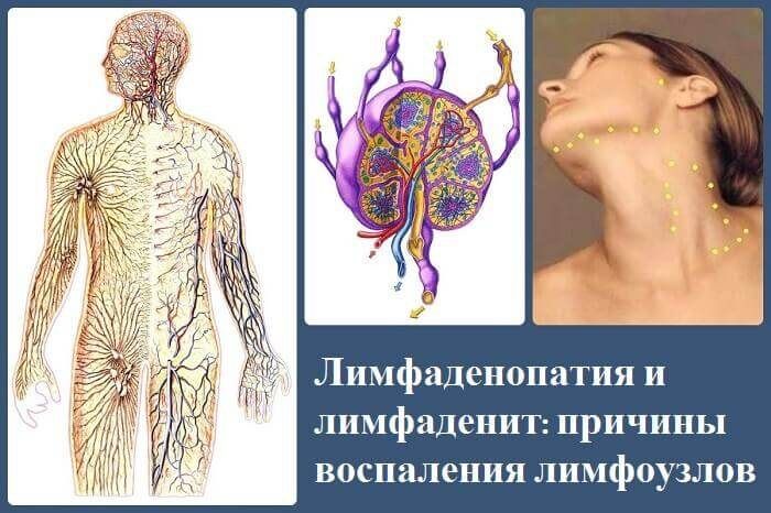 Лимфатическая система подобна кровеносной, с узлами вместо сердца Лимфатическая система подобна кровеносной, с узлами вместо сердца