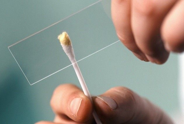Мазок из зева и носа Мазок из зева и носа