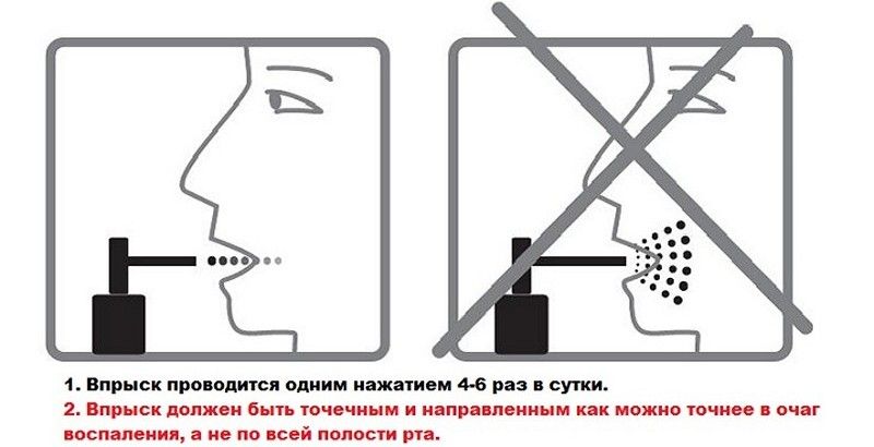 Помогает ли люголь при воспалении миндалин? Да, если правильно его применять. Помогает ли люголь при воспалении миндалин? Да, если правильно его применять.