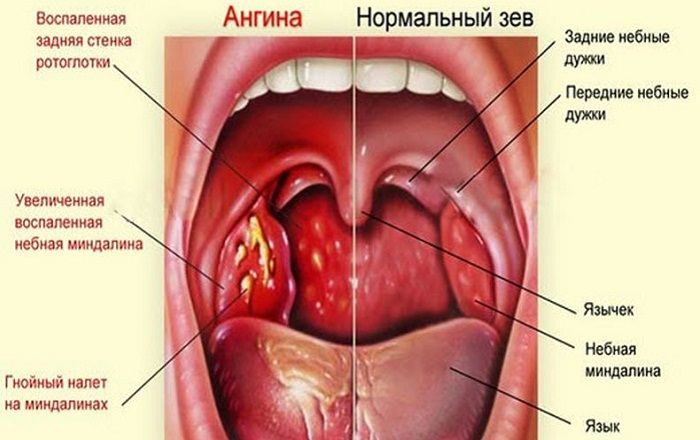 Симптомы знакомы многим Симптомы знакомы многим
