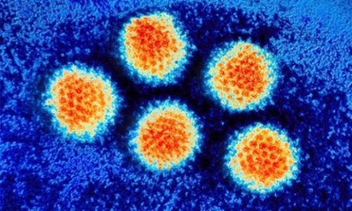 Вирусная ангина у детей чаще всего вызывается аденовирусами, которые провоцируют воспаление слизистой носоглотки и глаз, и характеризуется длительным волнообразным течением Вирусная ангина у детей чаще всего вызывается аденовирусами, которые провоцируют воспаление слизистой носоглотки и глаз, и характеризуется длительным волнообразным течением